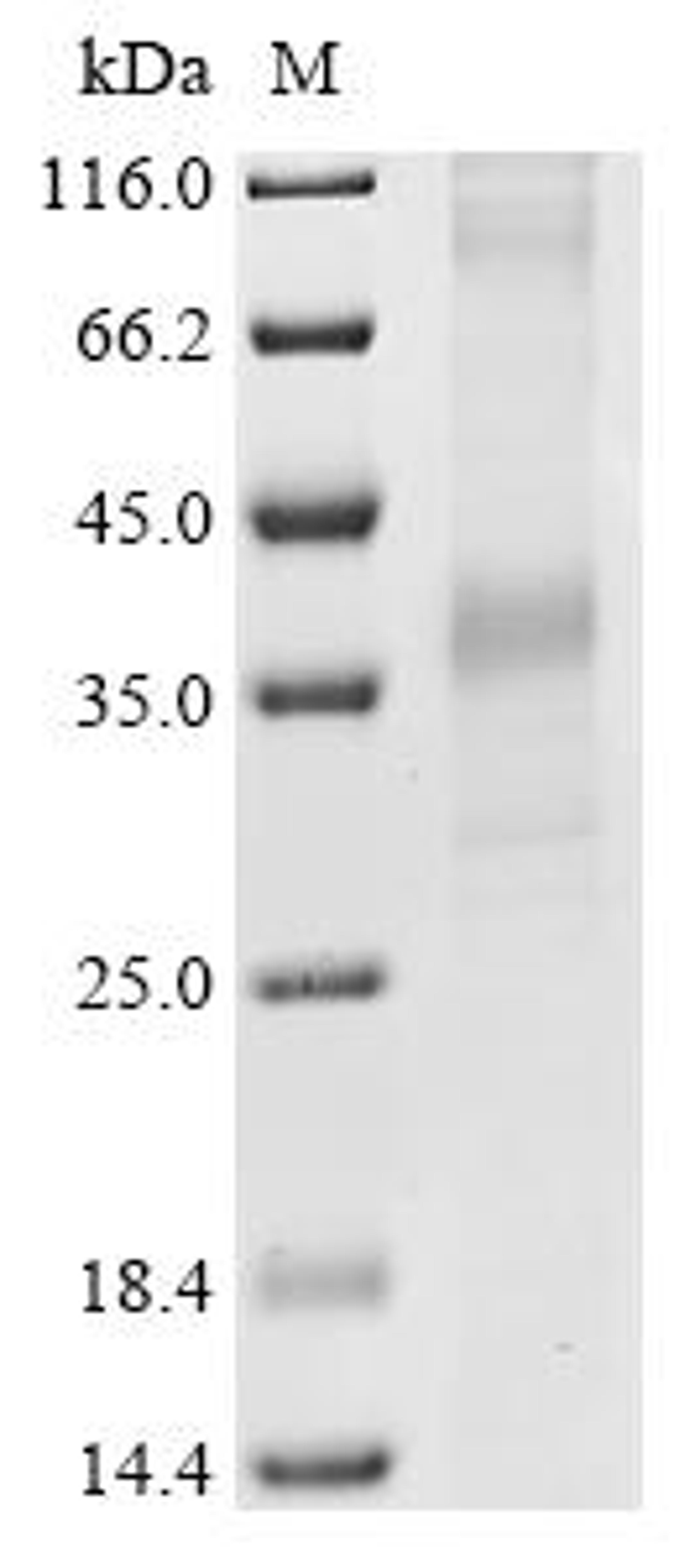(Tris-Glycine gel) Discontinuous SDS-PAGE (reduced) with 5% enrichment gel and 15% separation gel.