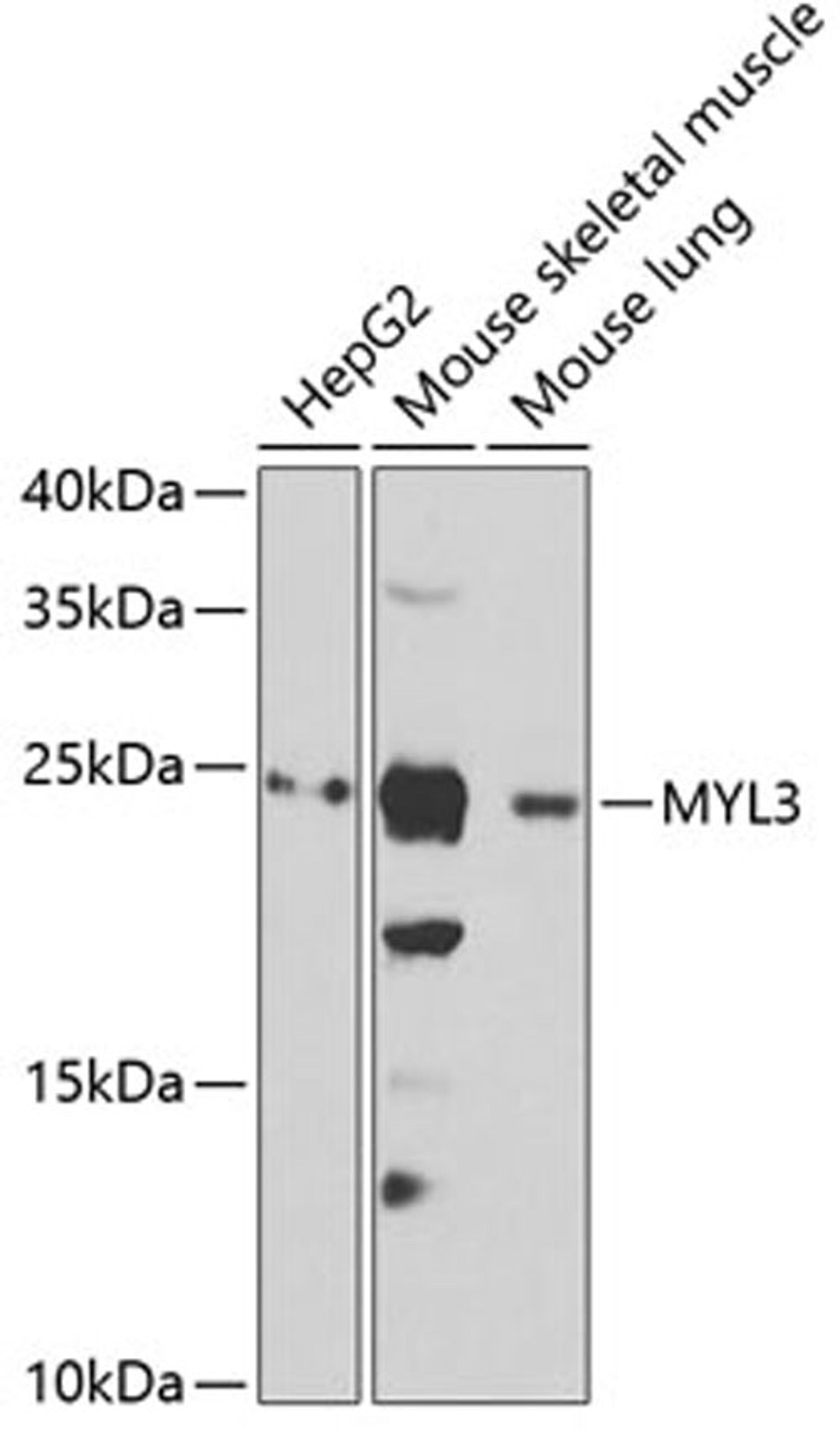 Western blot - MYL3 antibody (A6662)