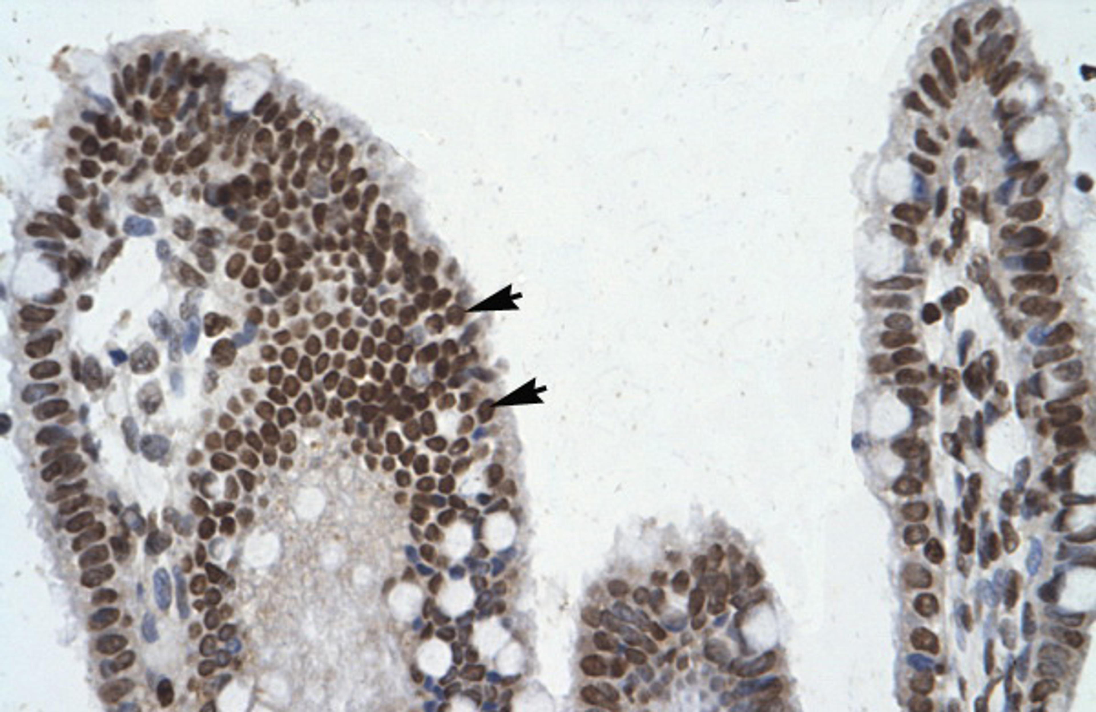 Antibody used in IHC on Human Intestine.