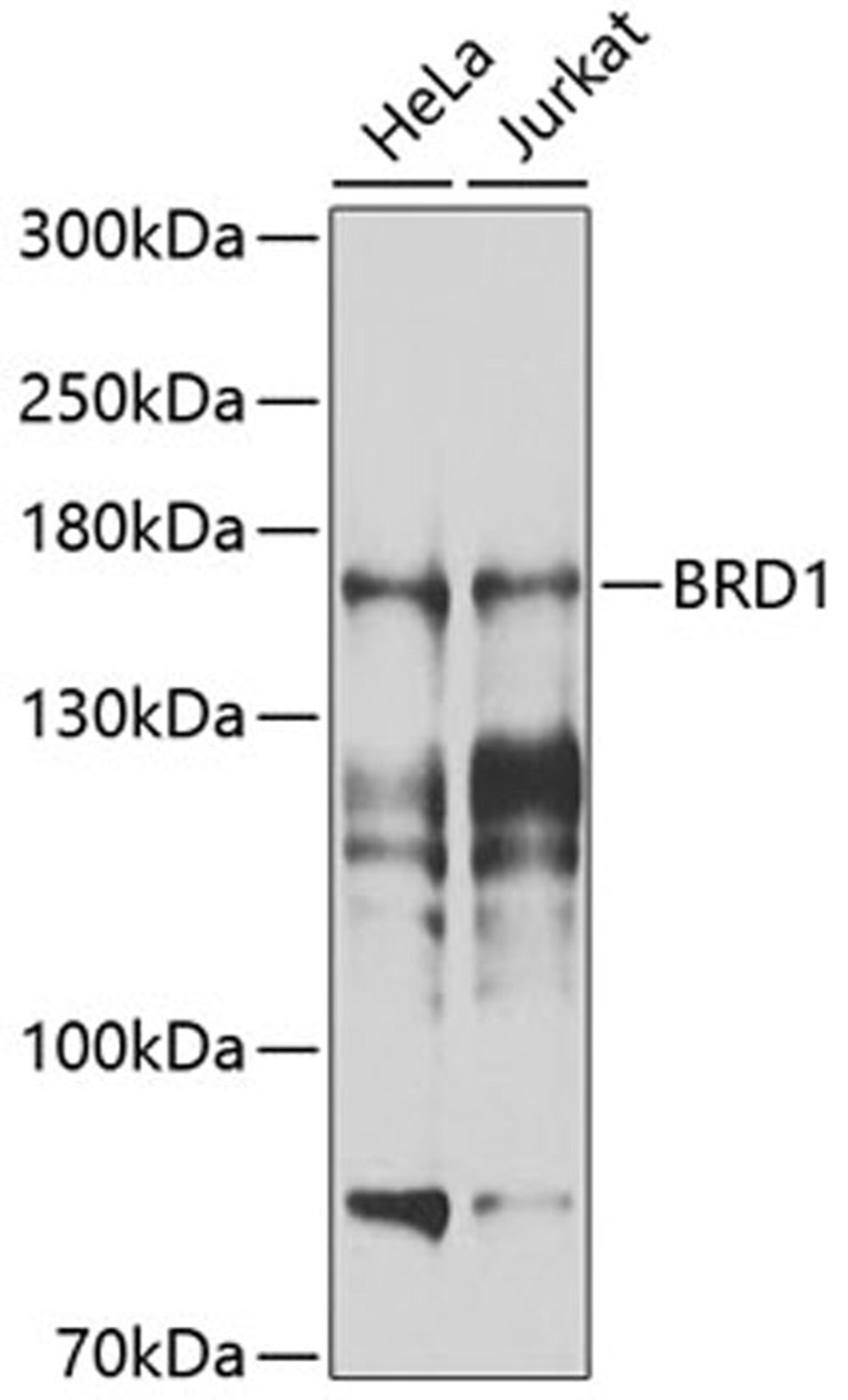 Western blot - BRD1 antibody (A9869)