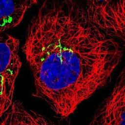 Immunocytochemistry/ Immunofluorescence: ZFPL1 Antibody [NBP1-85347] -  Staining of human cell line A-431 shows positivity in golgi apparatus.