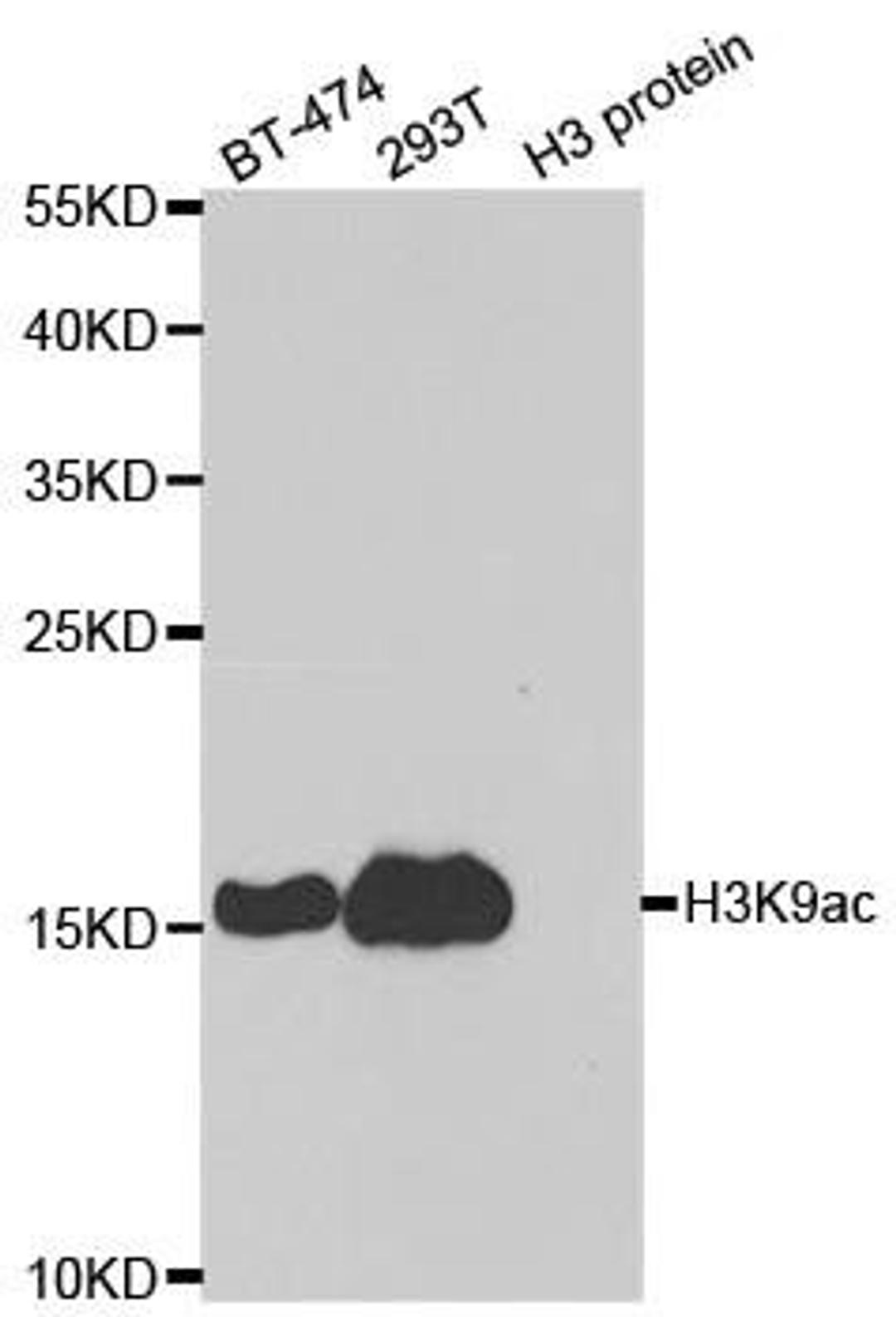 Western blot analysis of extracts of various cell lines and H3 protein expressed in E.coli. using Acetyl-Histone H3-K9 antibody