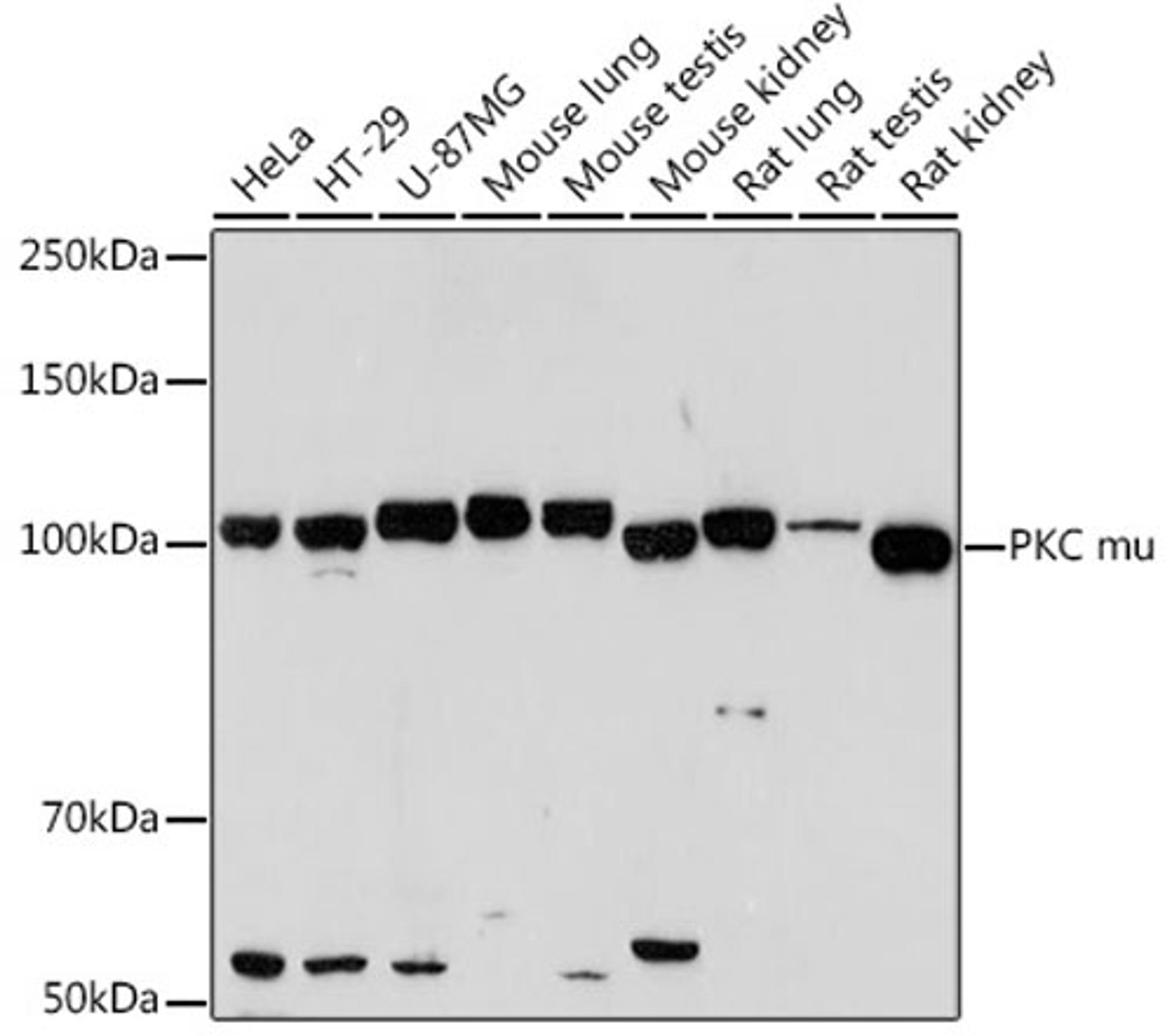 Western blot - PKC mu Rabbit mAb (A2417)