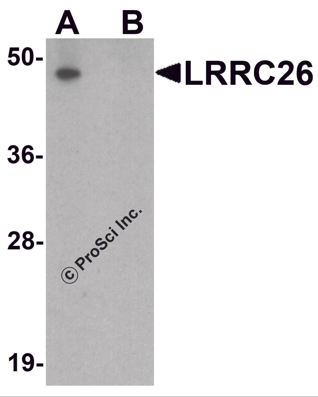 Western blot analysis of LRRC26 in human prostate tissue lysate with LRRC26 antibody at 0.5 μg/ml in (A) the absence and (B) the presence of blocking peptide.
