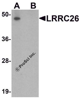 Western blot analysis of LRRC26 in human prostate tissue lysate with LRRC26 antibody at 0.5 μg/ml in (A) the absence and (B) the presence of blocking peptide.