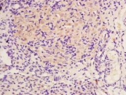 Immunohistochemical staining of rat ovary tissue using OSGIN1 antibody