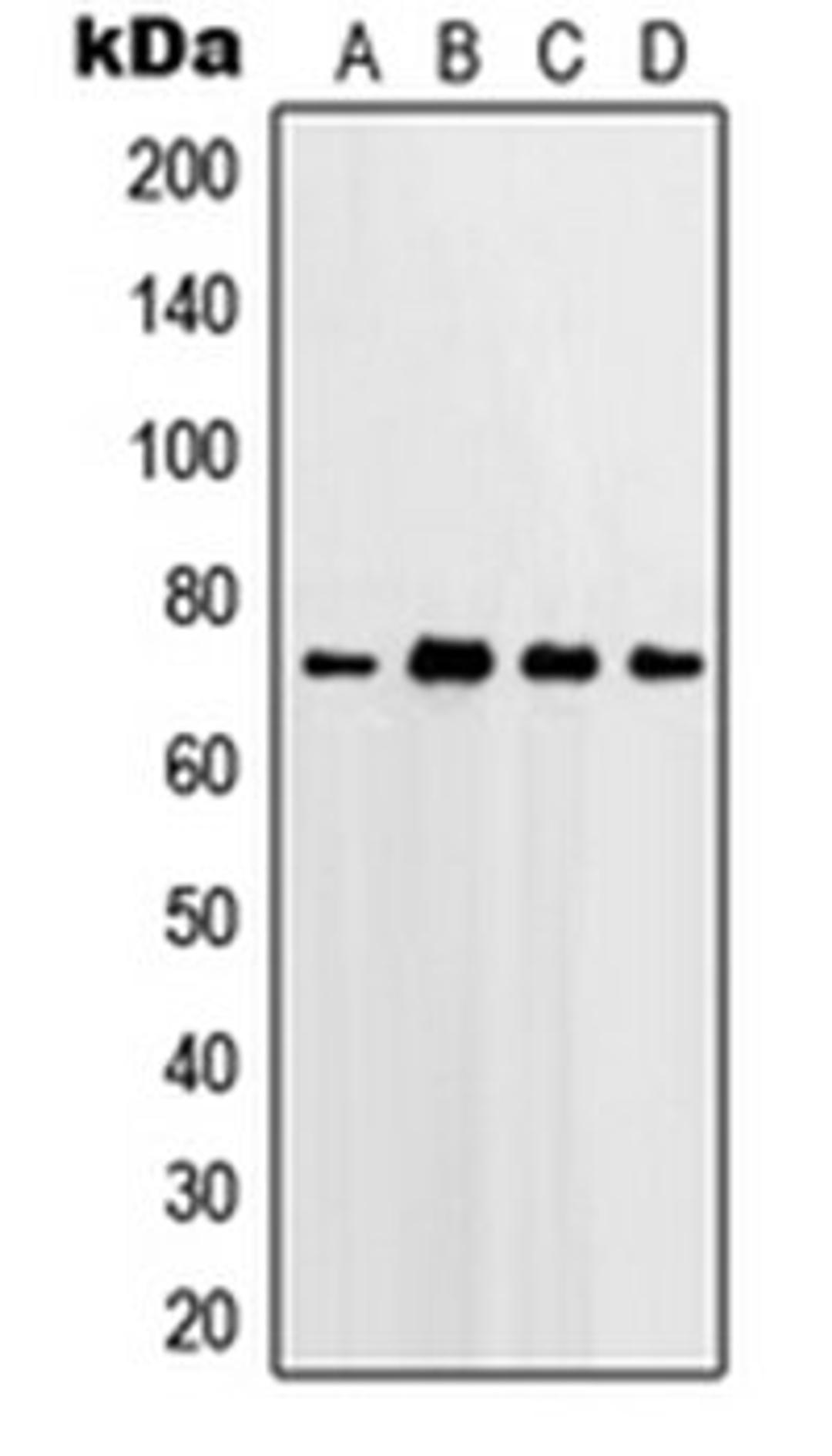 Western blot analysis of HeLa (Lane 1), Jurkat (Lane 2), Raw264.7 (Lane 3), rat lung (Lane 4) whole cell lysates using PTGS2 antibody