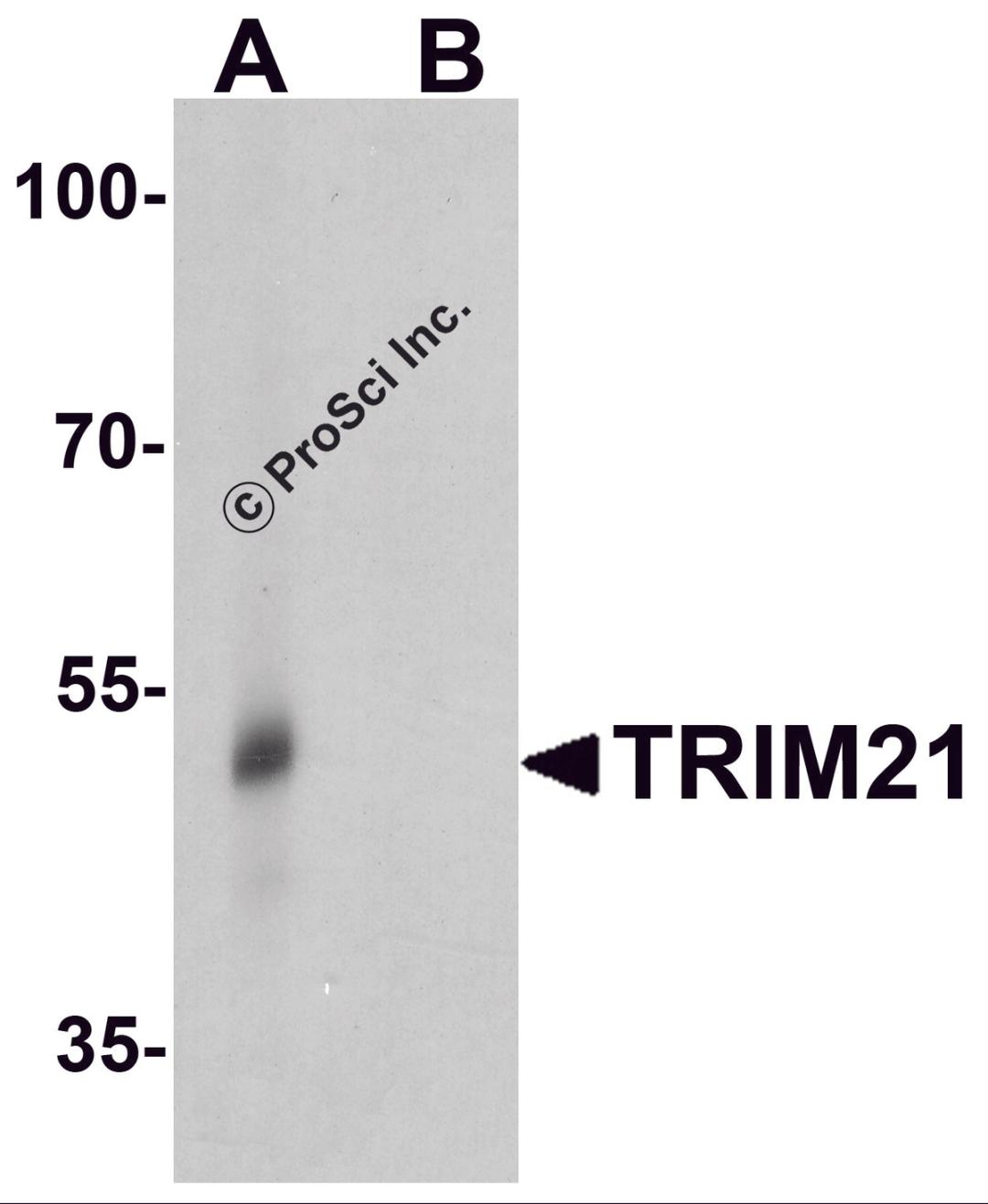 Western blot analysis of TRIM21 in human lung tissue lysate with TRIM21 antibody at 0.5 μg/ml in (A) the absence and (B) the presence of blocking peptide.