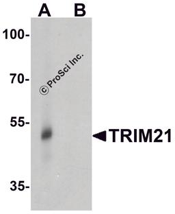 Western blot analysis of TRIM21 in human lung tissue lysate with TRIM21 antibody at 0.5 μg/ml in (A) the absence and (B) the presence of blocking peptide.
