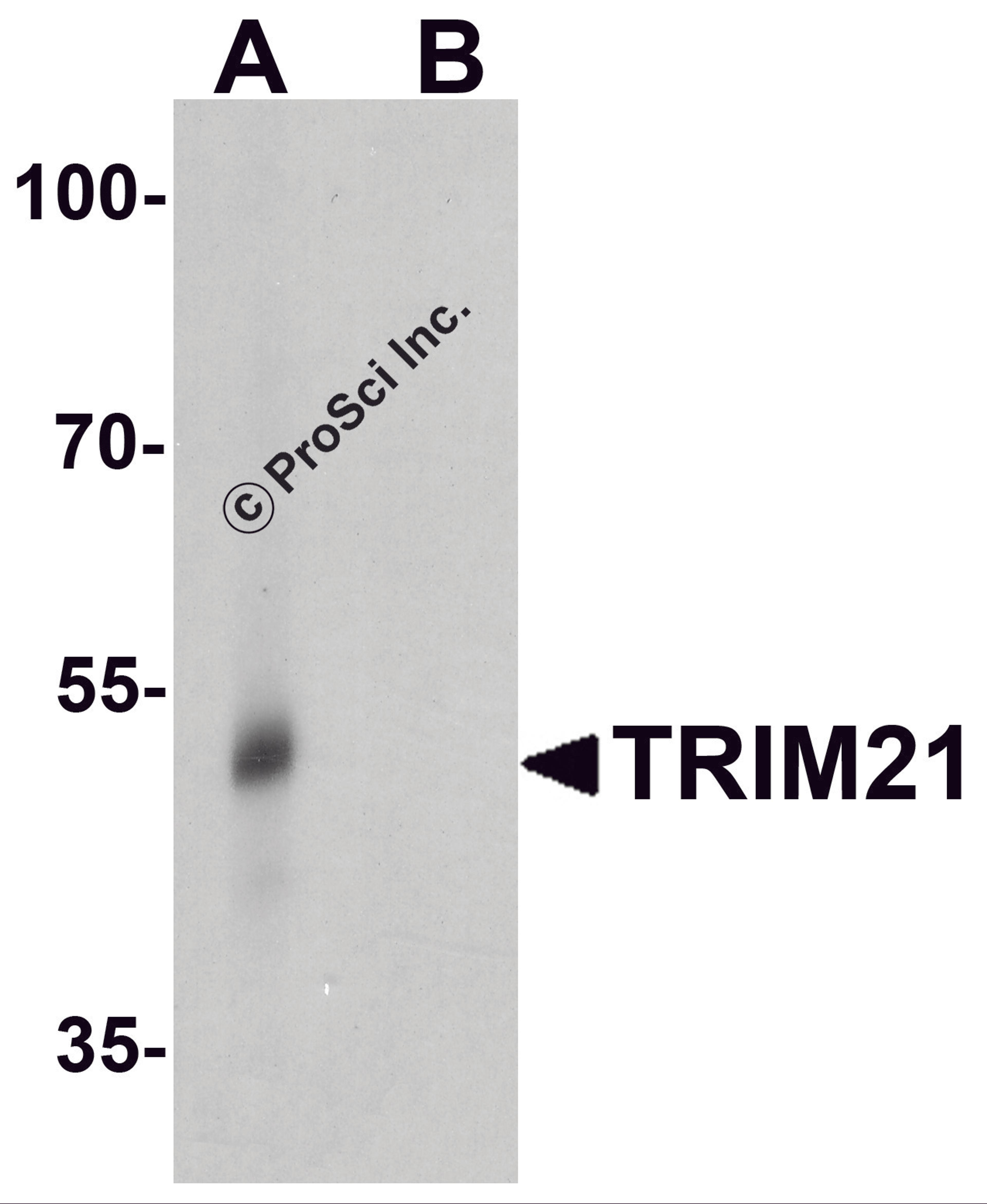 Western blot analysis of TRIM21 in human lung tissue lysate with TRIM21 antibody at 0.5 μg/ml in (A) the absence and (B) the presence of blocking peptide.