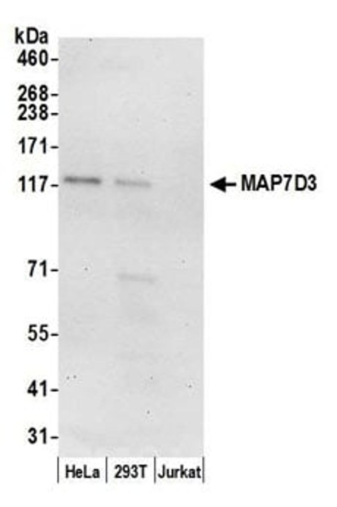 Detection of human MAP7D3 by western blot.