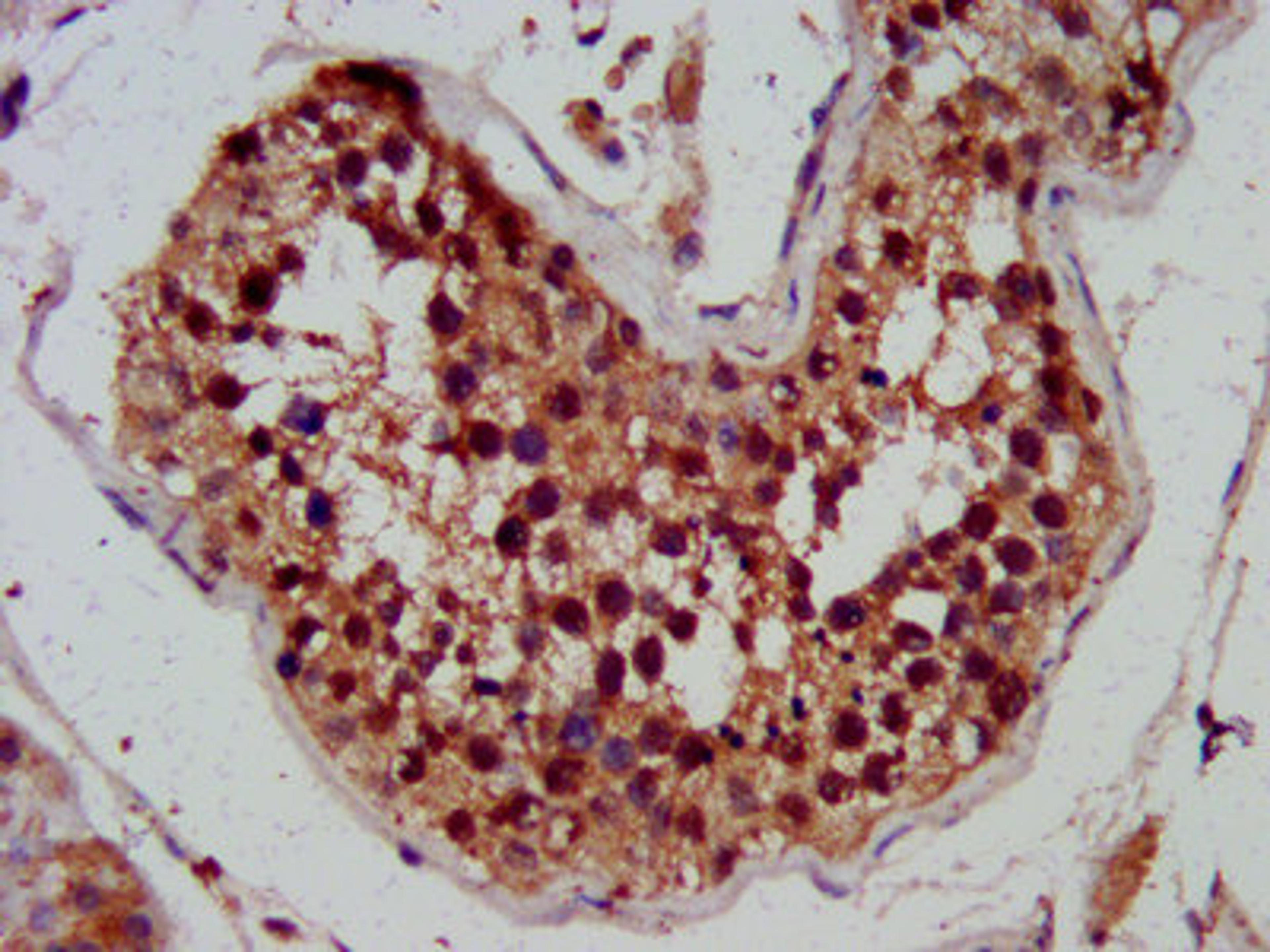 IHC image of CSB-PA816899LA01HU diluted at 1:300 and staining in paraffin-embedded human testis tissue performed on a Leica BondTM system. After dewaxing and hydration, antigen retrieval was mediated by high pressure in a citrate buffer (pH 6.0). Section was blocked with 10% normal goat serum 30min at RT. Then primary antibody (1% BSA) was incubated at 4&deg;C overnight. The primary is detected by a biotinylated secondary antibody and visualized using an HRP conjugated SP system.