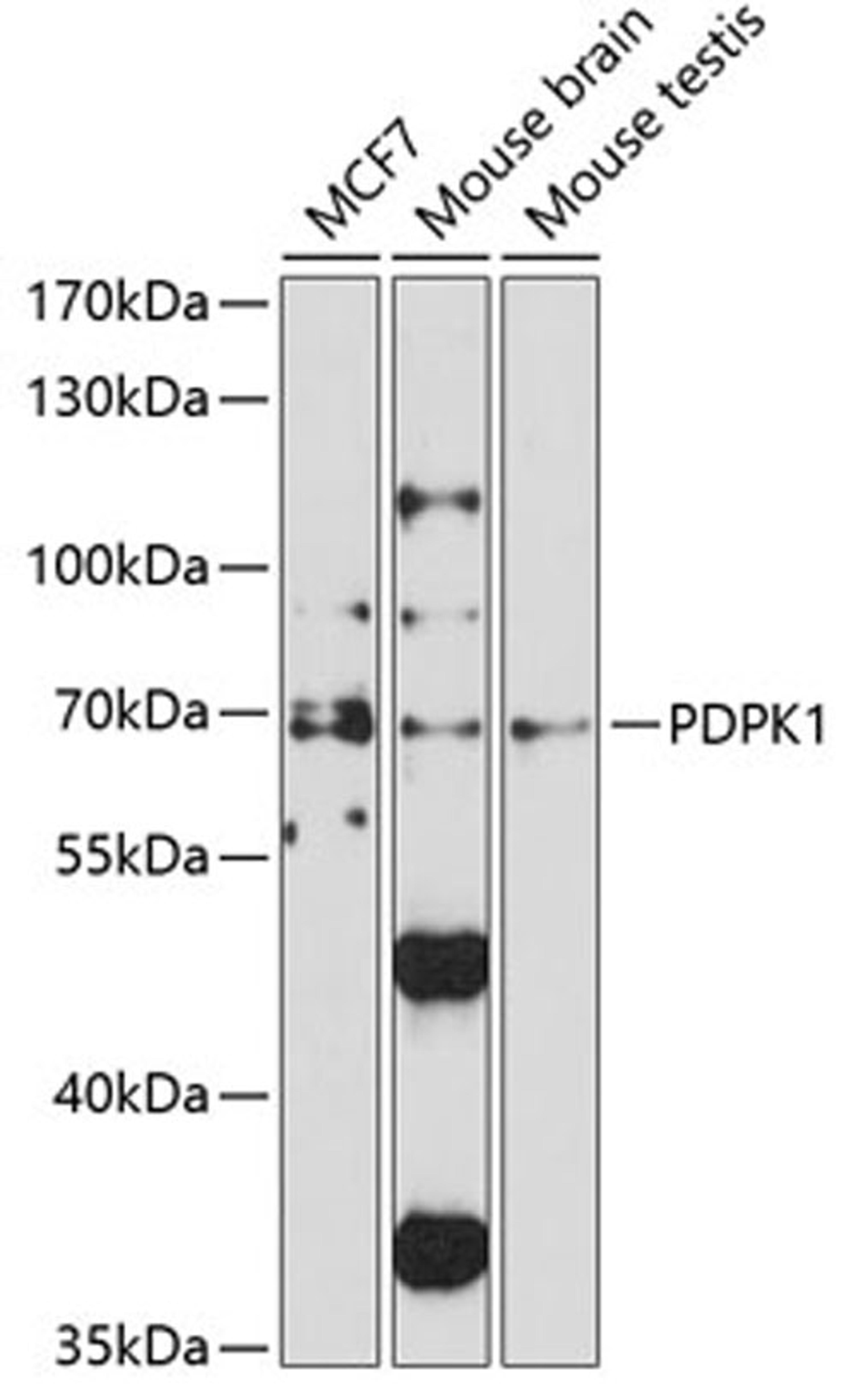 Western blot - PDPK1 antibody (A1665)