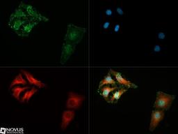 Immunocytochemistry/Immunofluorescence: 14-3-3 gamma [ac Val2] Antibody (KC21) [NB100-406] - 14-3-3 gamma [ac  Val2] antibody was tested in SH-SY5Y cells with DyLight 488 (green). Nuclei and alpha-tubulin were counterstained with DAPI (blue) and Dylight 550 (red).