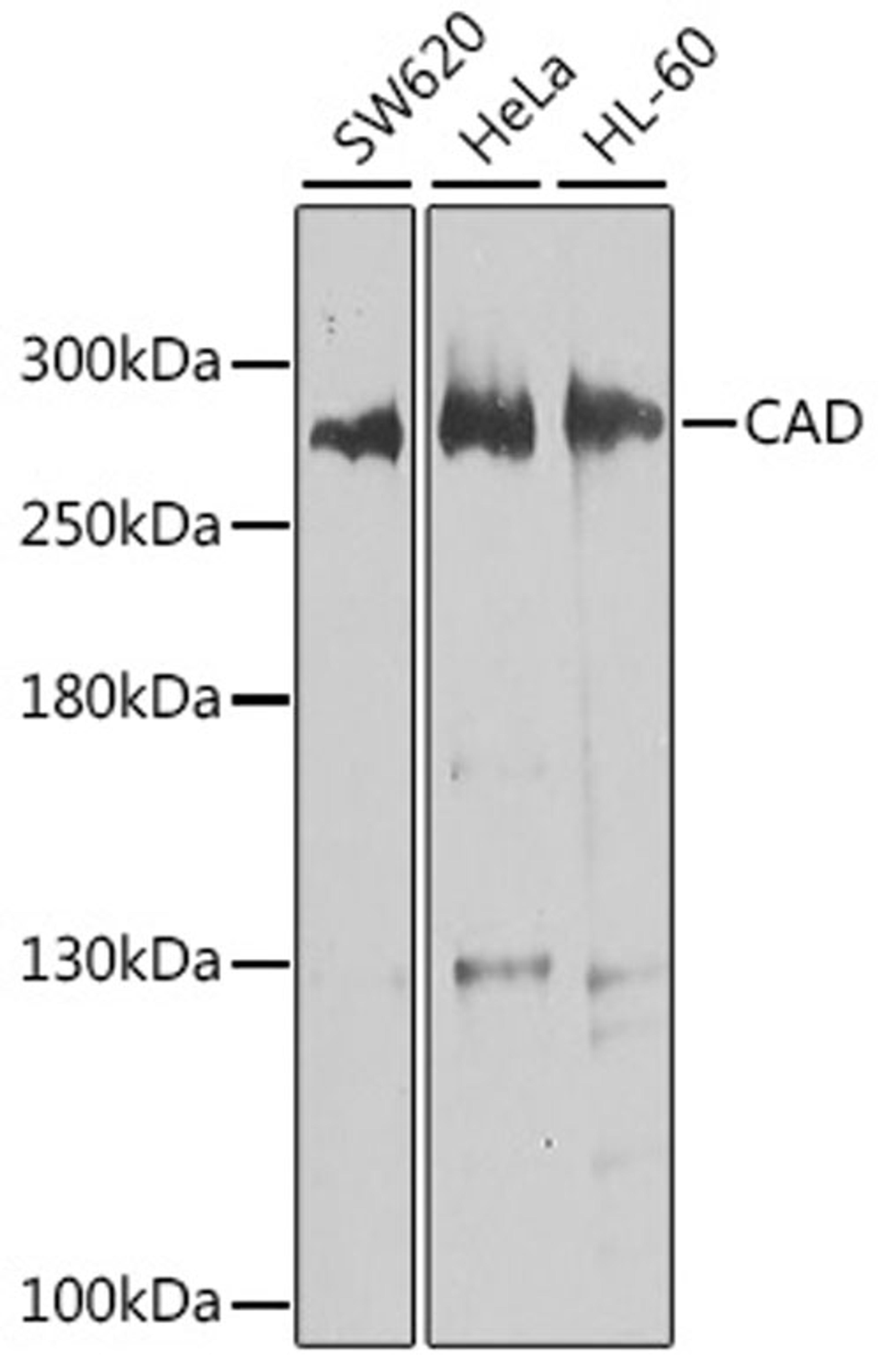 Western blot - CAD antibody (A8344)