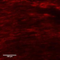 Immunocytochemistry/Immunofluorescence: Collagen I alpha 1 Antibody [NB600-408] - Staining of human dermal fibroblast derived cell sheet. Image provided by product review by verified customer.