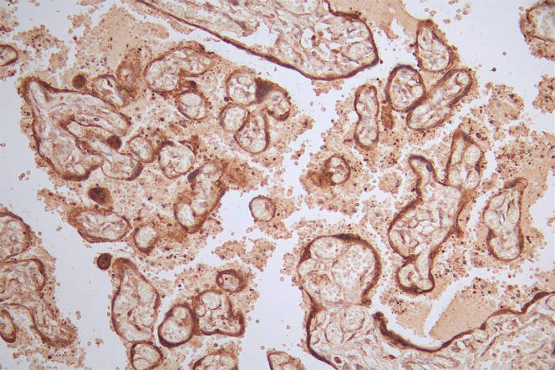 IHC image of CSB-RA071064A0HU diluted at 1:100 and staining in paraffin-embedded human placenta tissue performed on a Leica BondTM system. After dewaxing and hydration, antigen retrieval was mediated by high pressure in a citrate buffer (pH 6.0). Section was blocked with 10% normal goat serum 30min at RT. Then primary antibody (1% BSA) was incubated at 4°C overnight. The primary is detected by a Goat anti-rabbit polymer IgG labeled by HRP and visualized using 0.50% DAB.