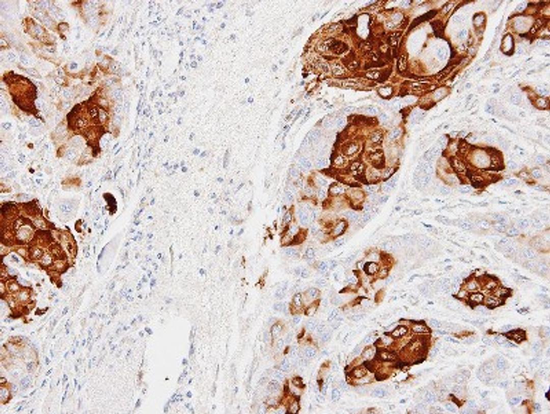 Immunohistochemistry-Paraffin: CCL28 Antibody [NBP1-31157] - Paraffin-embedded Cal27 xenograft, using antibody at 1:100 dilution.