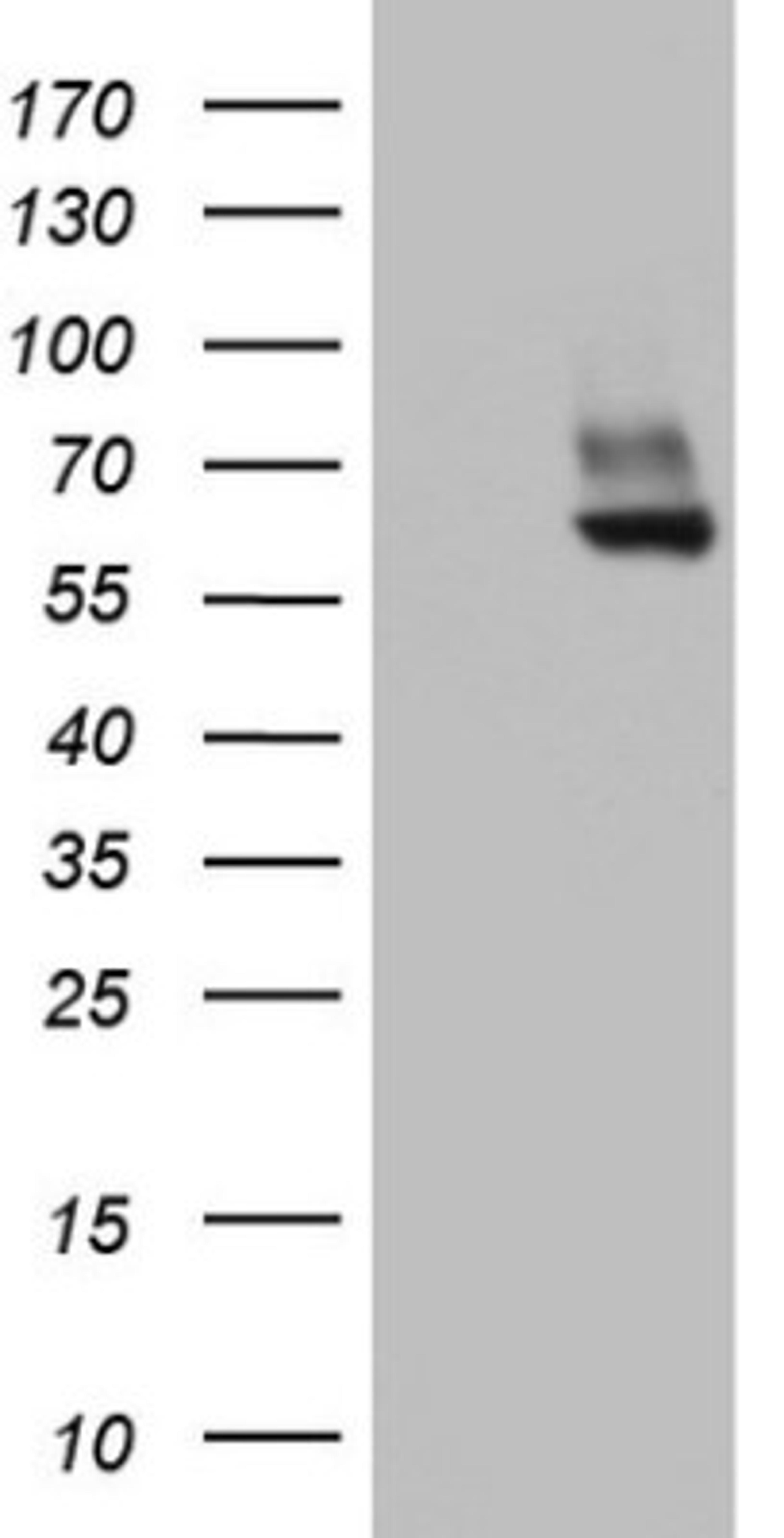 Western Blot: PDE1A Antibody (7D5) [NBP2-46355] - Analysis of HEK293T cells were transfected with the pCMV6-ENTRY control (Left lane) or pCMV6-ENTRY PDE1A .