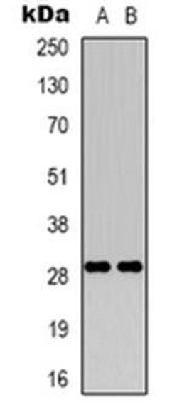 Western blot analysis of RAB34 expression in HEK293T (Lane 1), Hela (Lane 2) whole cell lysates using RAB34 antibody