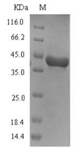 (Tris-Glycine gel) Discontinuous SDS-PAGE (reduced) with 5% enrichment gel and 15% separation gel.