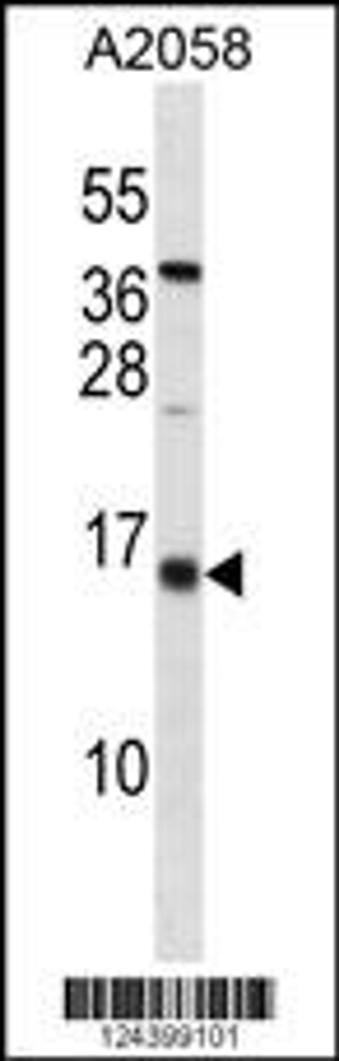 Western blot analysis in A2058 cell line lysates (35ug/lane).