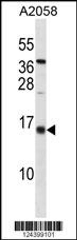 Western blot analysis in A2058 cell line lysates (35ug/lane).