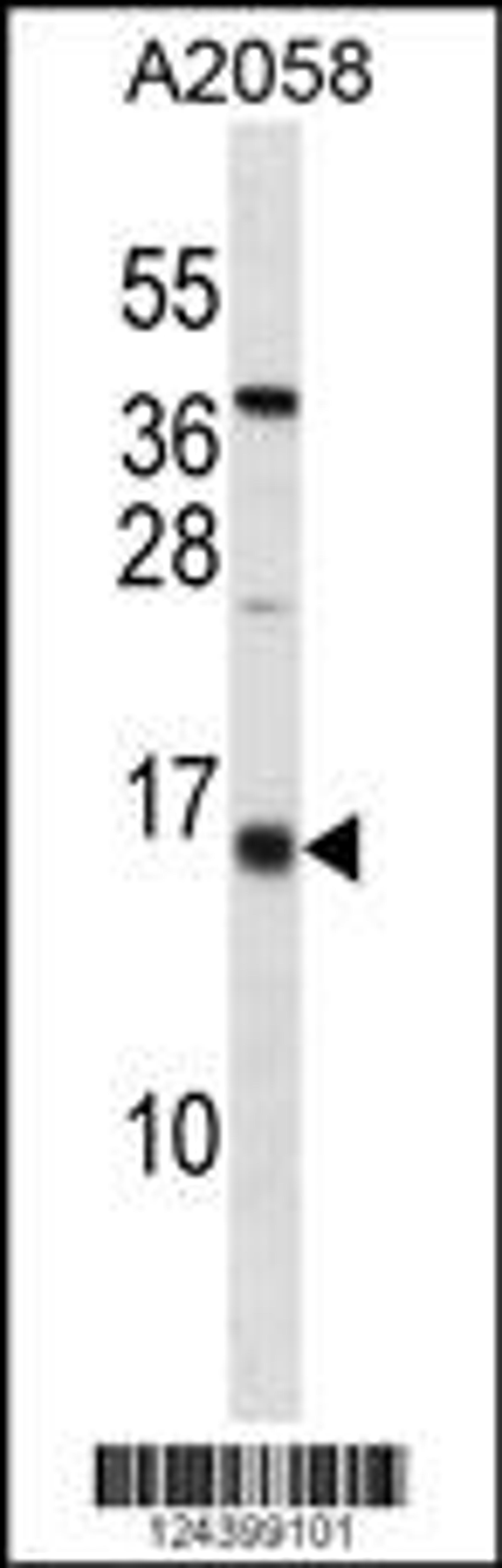 Western blot analysis in A2058 cell line lysates (35ug/lane).