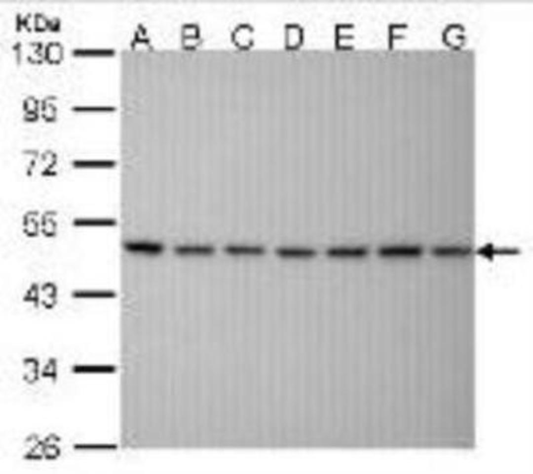 Western Blot: SUG1 Antibody (25D5) [NB100-345] - SUG1 antibody with 30 ug whole cell lysate run on SDS-PAGE. Lane A: 293T; B: A431; C: H1299; D: Hela; E: Hep G2; F: Molt-4; G: Raji