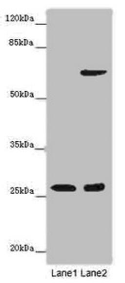 Western blot. All lanes: SOX14 antibody at 14ug/ml. Lane 1: Human placenta tissue. Lane 2: HepG2 whole cell lysate. Secondary. Goat polyclonal to rabbit IgG at 1/10000 dilution. Predicted band size: 27 kDa. Observed band size: 27 kDa. 