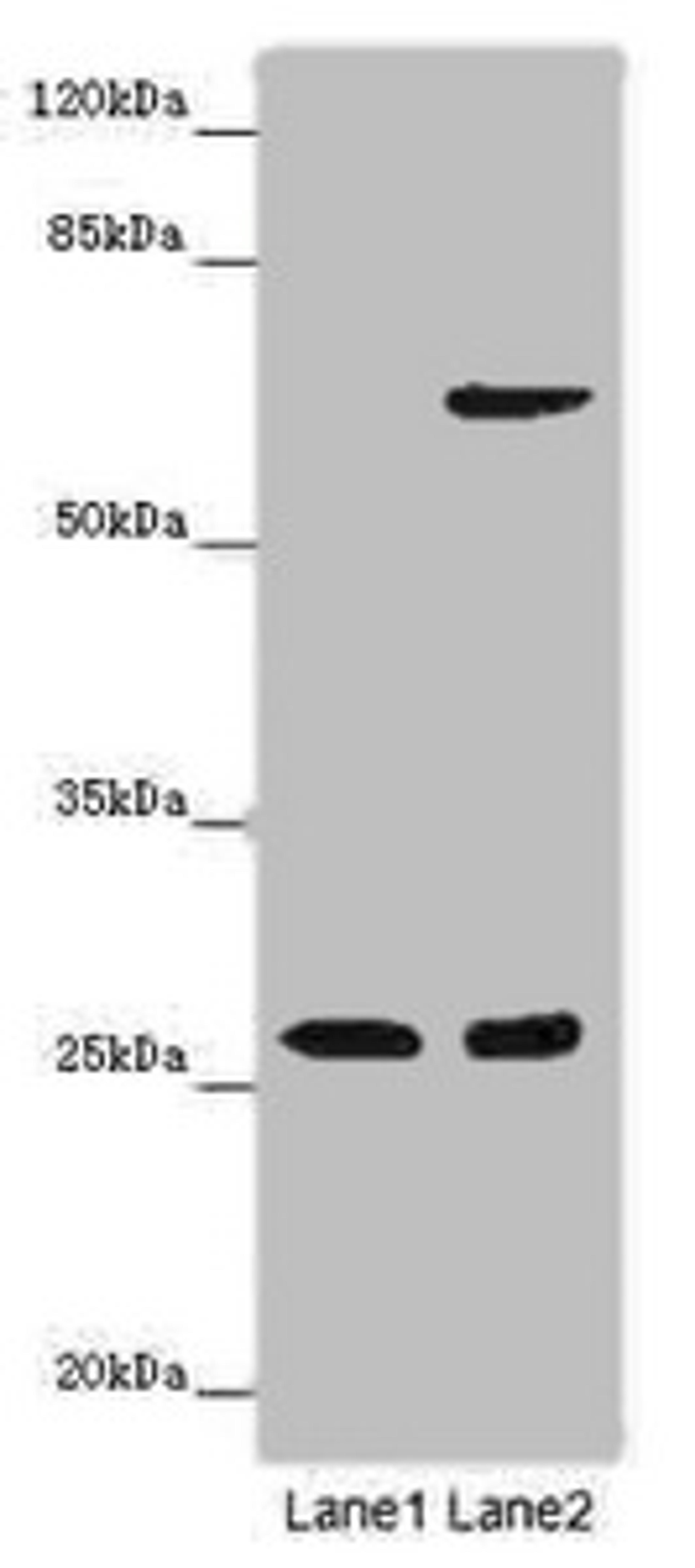 Western blot. All lanes: SOX14 antibody at 14ug/ml. Lane 1: Human placenta tissue. Lane 2: HepG2 whole cell lysate. Secondary. Goat polyclonal to rabbit IgG at 1/10000 dilution. Predicted band size: 27 kDa. Observed band size: 27 kDa. 