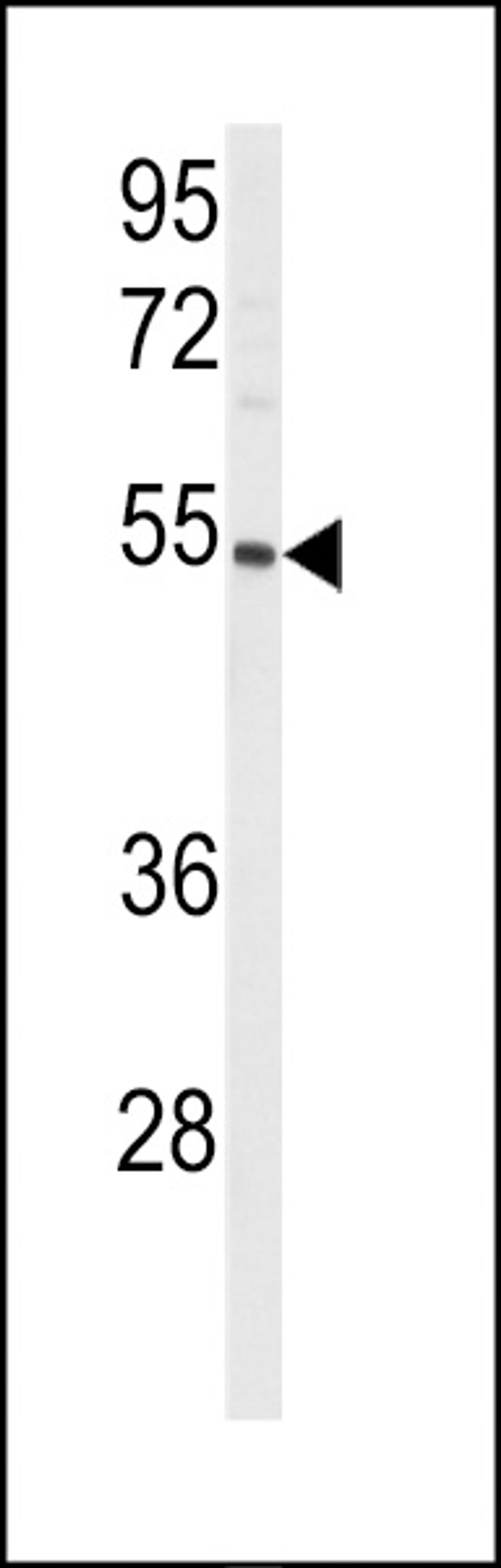 Western blot analysis of anti-CYP8A1 Antibody in mouse lung tissue lysates (35ug/lane).