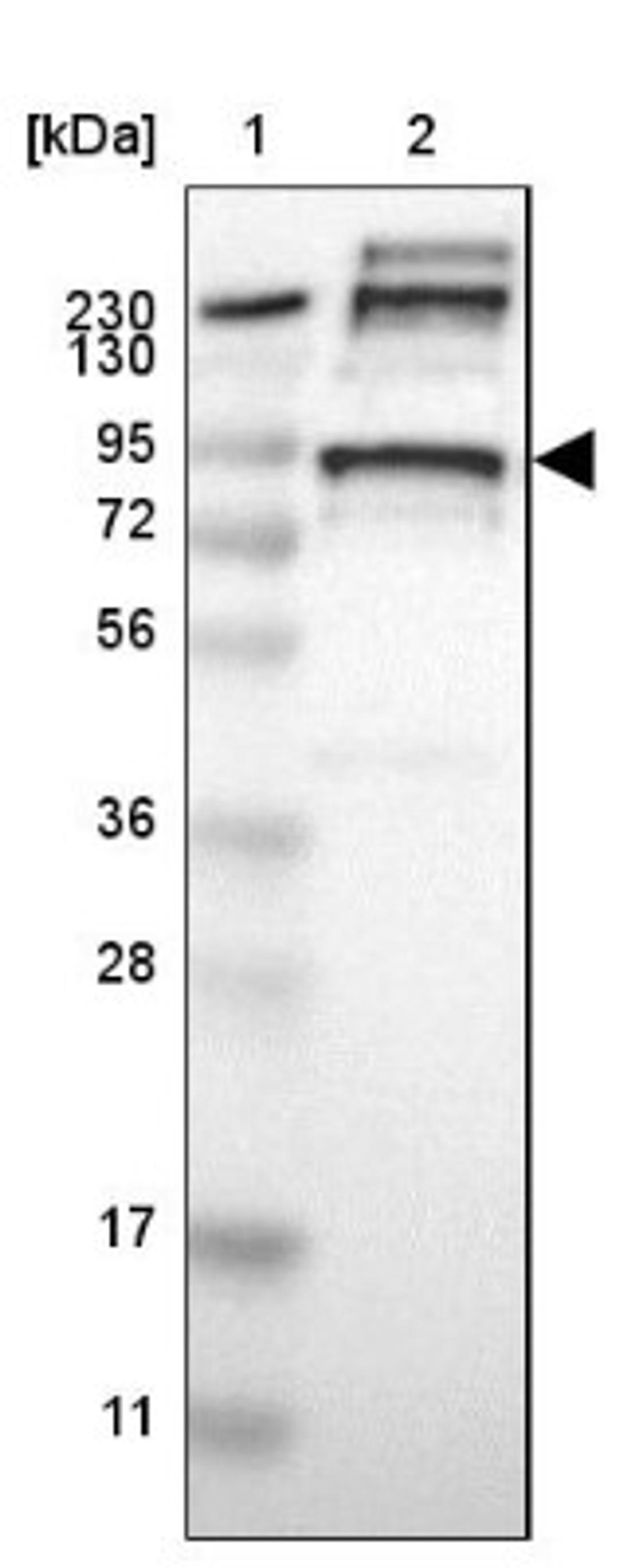 Western Blot: KIF3B Antibody [NBP1-81512] - Lane 1: Marker [kDa] 230, 130, 95, 72, 56, 36, 28, 17, 11<br/>Lane 2: Human cell line RT-4