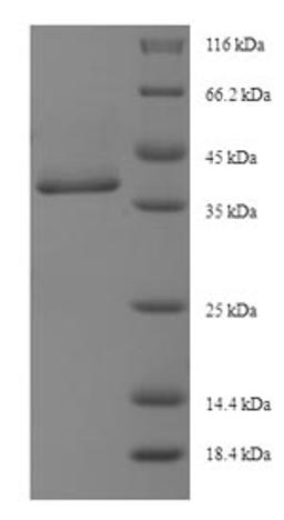 (Tris-Glycine gel) Discontinuous SDS-PAGE (reduced) with 5% enrichment gel and 15% separation gel.