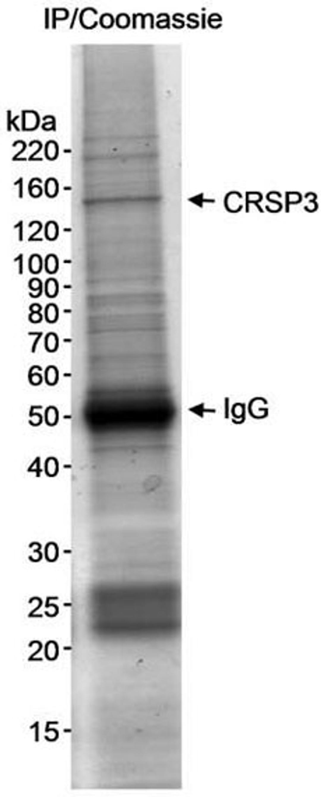 Detection of human CRSP3 by immunoprecipitation.