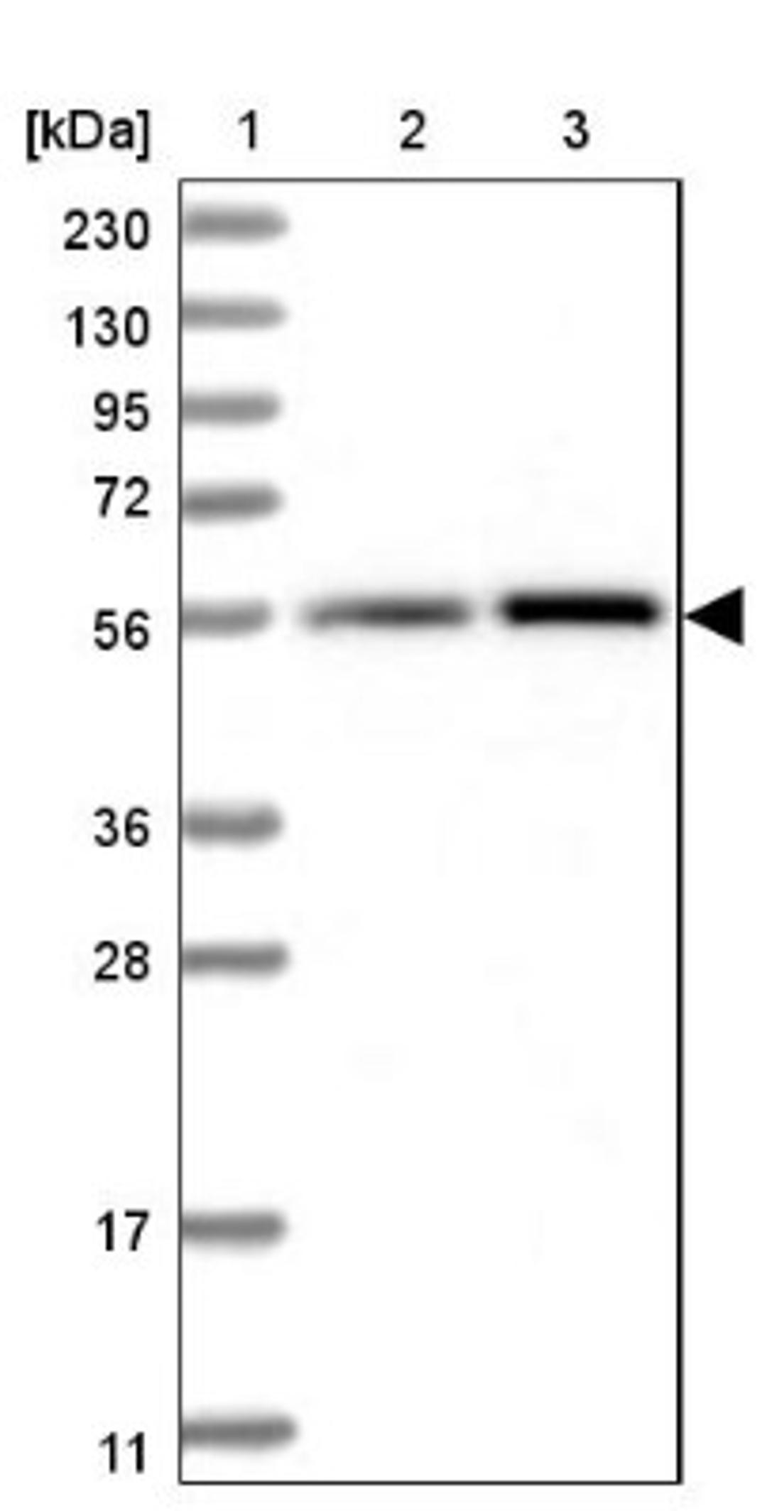 Western Blot: LAP3 Antibody [NBP1-82847] - Lane 1: Marker [kDa] 230, 130, 95, 72, 56, 36, 28, 17, 11<br/>Lane 2: Human cell line RT-4<br/>Lane 3: Human cell line U-251MG sp