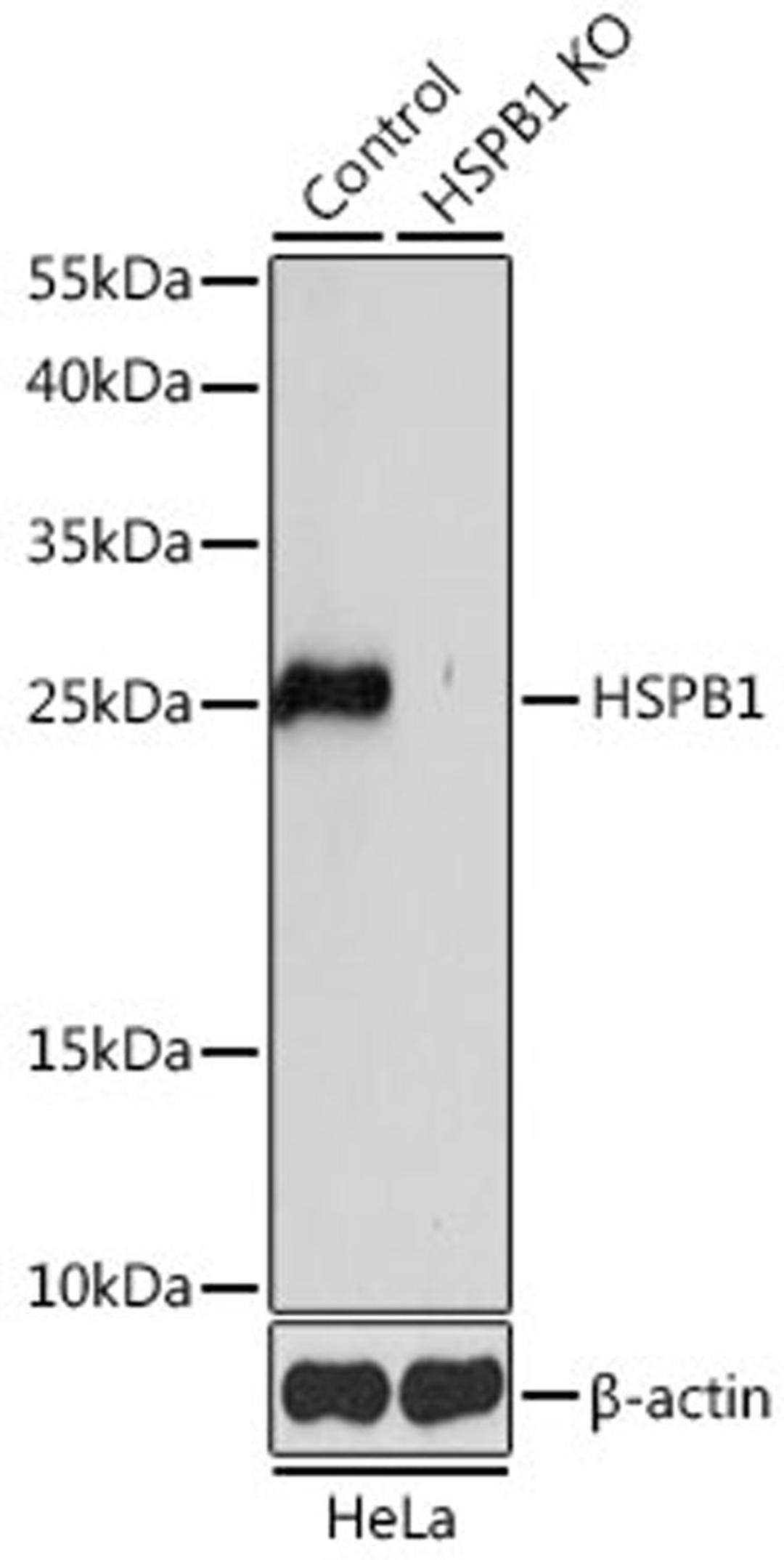 Western blot - HSPB1 antibody (A16332)