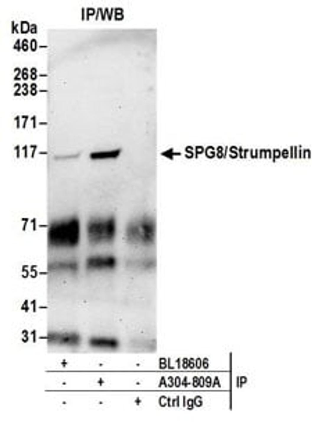 Detection of human SPG8/Strumpellin by western blot of immunoprecipitates.