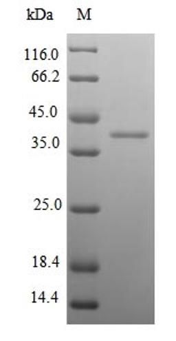 (Tris-Glycine gel) Discontinuous SDS-PAGE (reduced) with 5% enrichment gel and 15% separation gel.