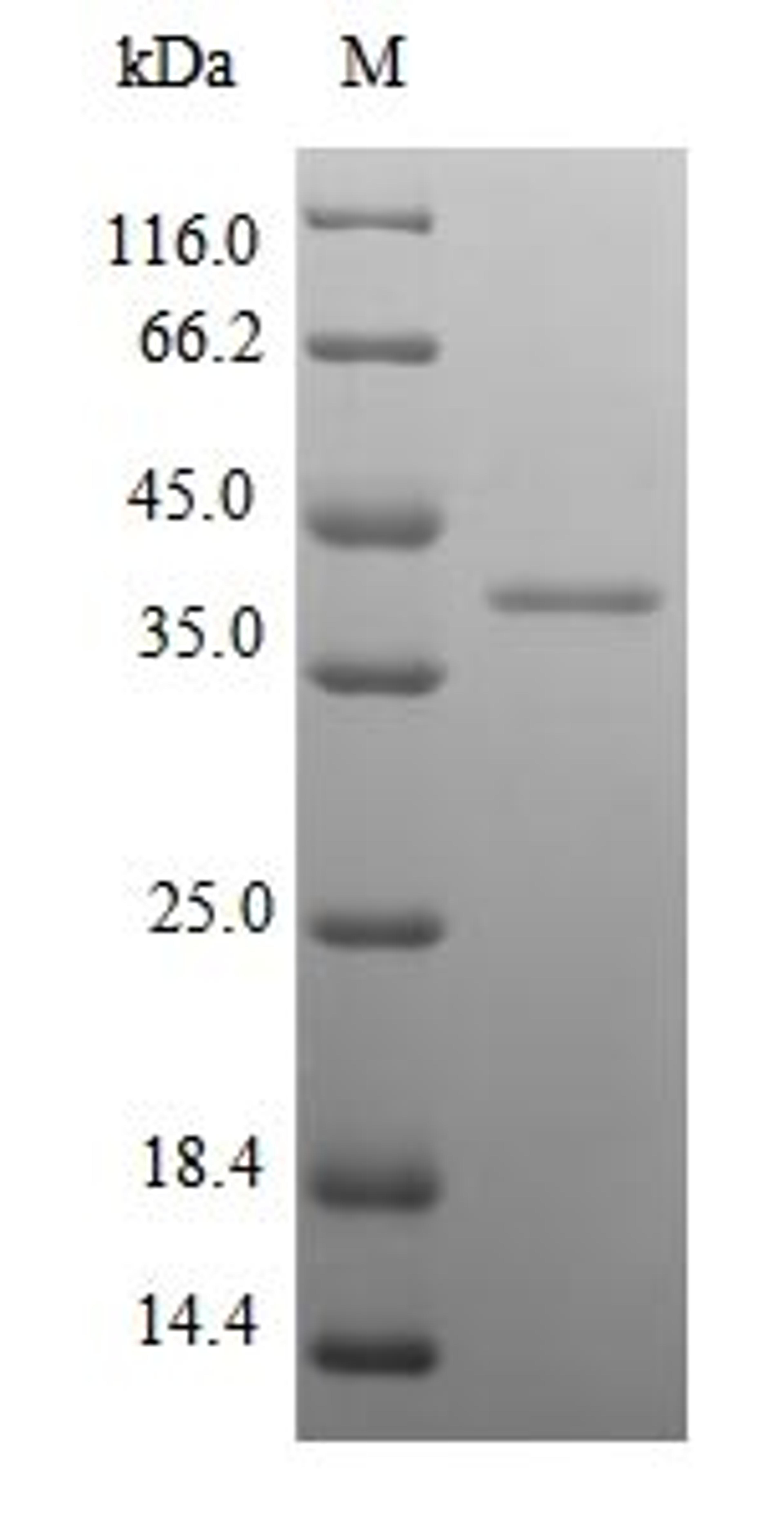 (Tris-Glycine gel) Discontinuous SDS-PAGE (reduced) with 5% enrichment gel and 15% separation gel.