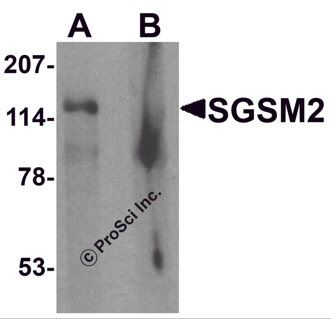 Western blot analysis of SGSM2 in human cerebellum tissue lysate with SGSM2 antibody at 1 μg/ml in (A) the absence and (B) the presence of blocking peptide