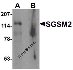 Western blot analysis of SGSM2 in human cerebellum tissue lysate with SGSM2 antibody at 1 μg/ml in (A) the absence and (B) the presence of blocking peptide