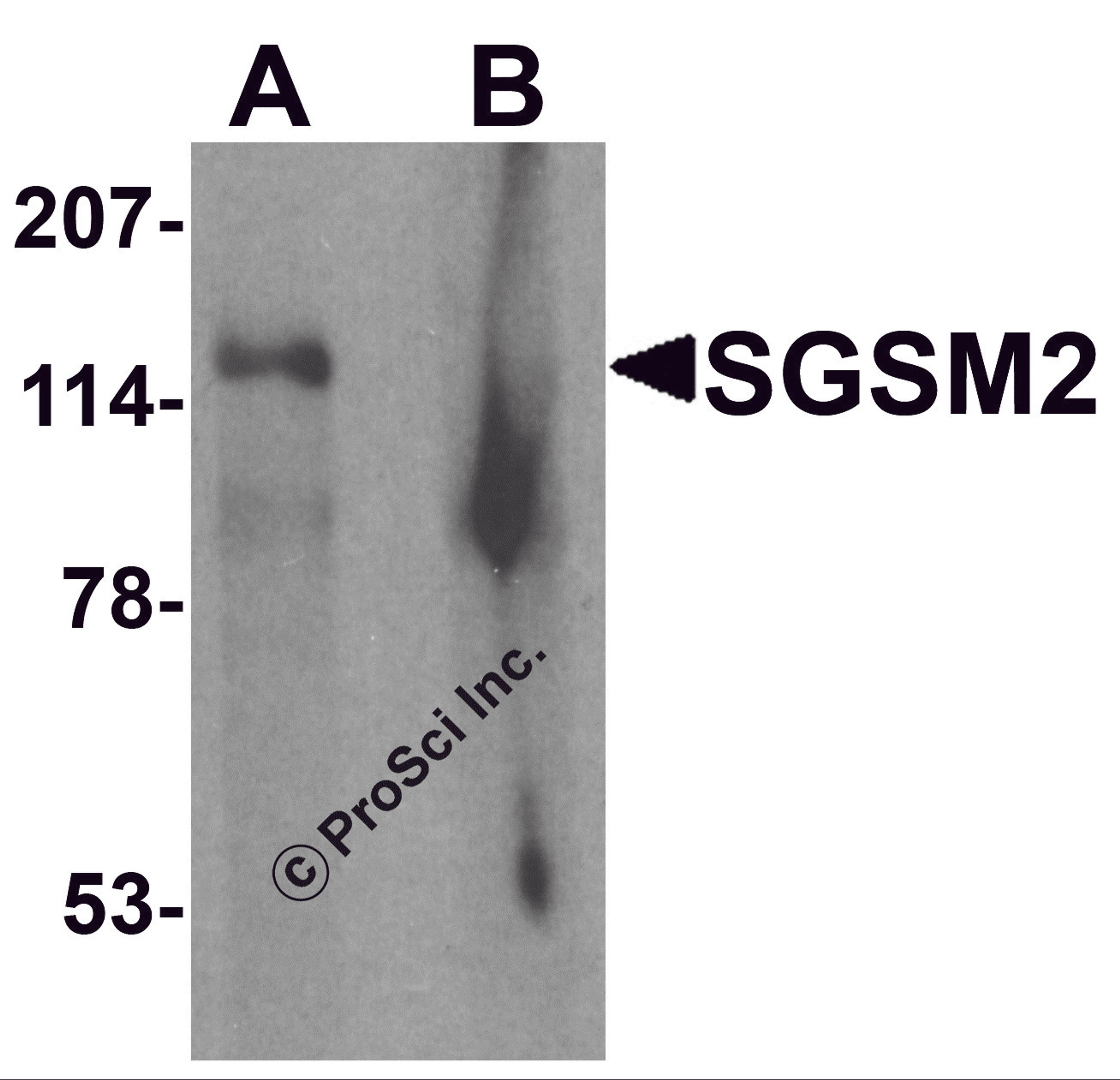 Western blot analysis of SGSM2 in human cerebellum tissue lysate with SGSM2 antibody at 1 μg/ml in (A) the absence and (B) the presence of blocking peptide