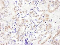 Detection of human EXOSC10 by immunohistochemistry.