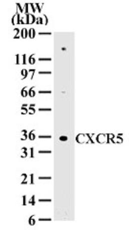 Western Blot: CXCR5 Antibody [NB100-56333] - analysis of 20 ug of total cell lysate from Daudi cells with this antibody at 2ug/ml dilution.