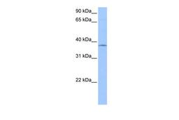 Antibody used in WB on Human HepG2 at 0.2-1 ug/ml.