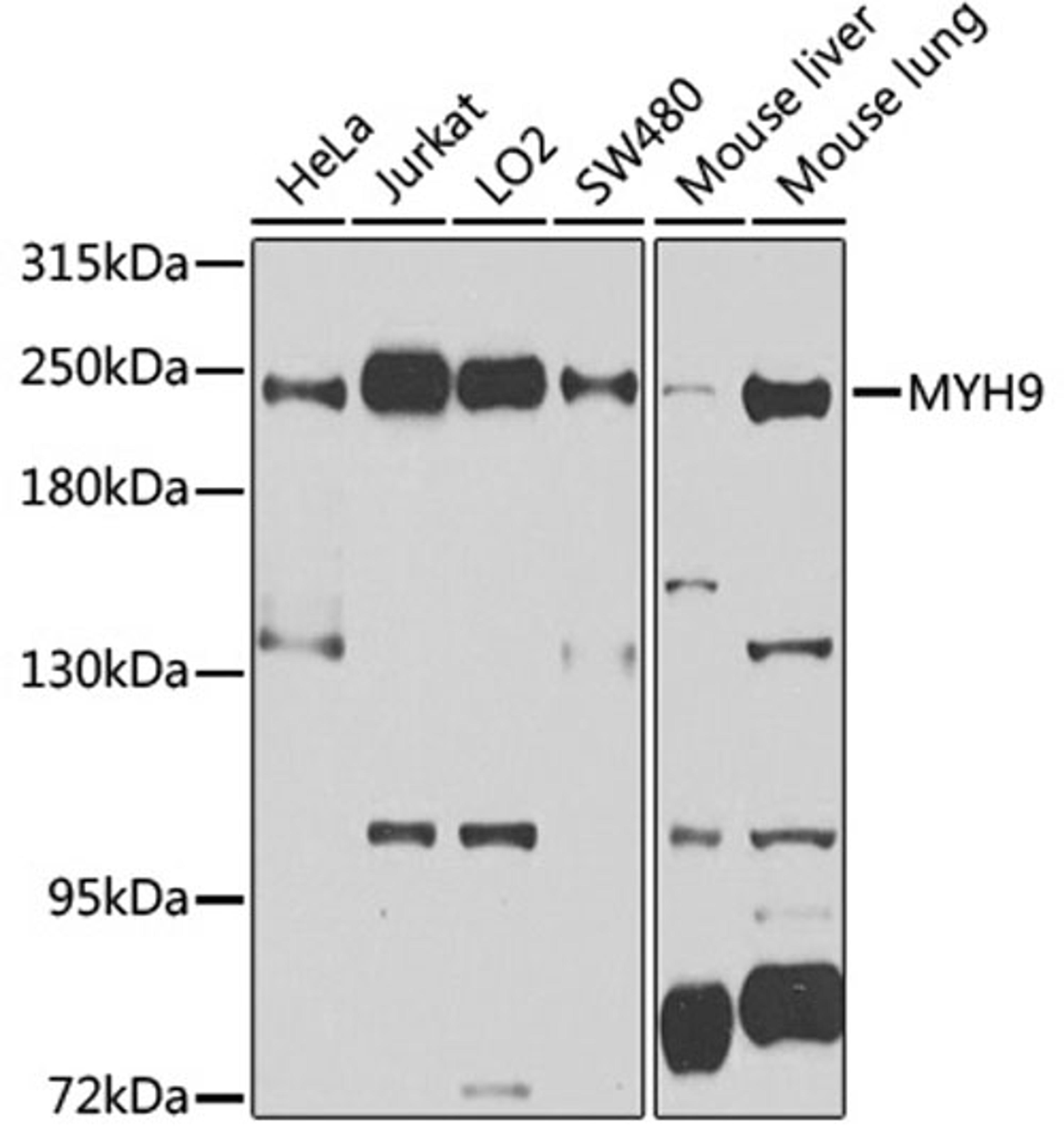 Western blot - MYH9 antibody (A0173)