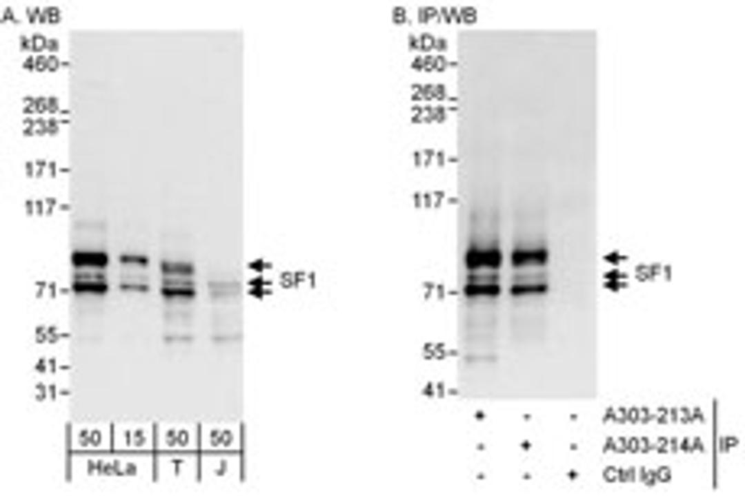 Detection of human SF1 by western blot and immunoprecipitation.