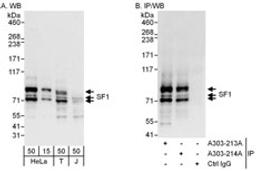 Detection of human SF1 by western blot and immunoprecipitation.