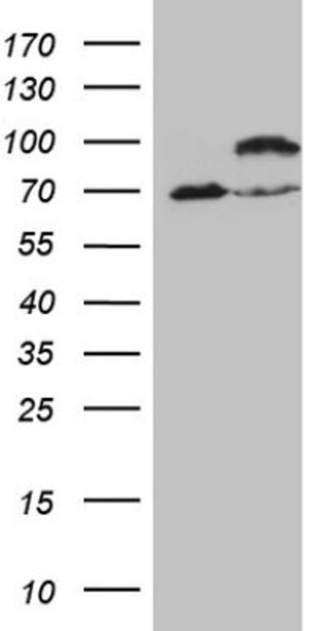 Western Blot: IKK epsilon/IKBKE Antibody (3C5) [NBP2-46047] - Analysis of HEK293T cells were transfected with the pCMV6-ENTRY control (Left lane) or pCMV6-ENTRY IKBKE.